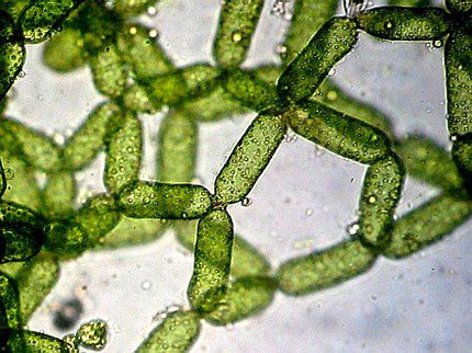Kolonier av encelliga alger under ett mikroskop